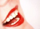 Teeth Bleaching - 